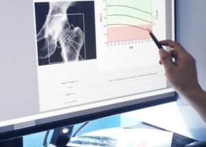 SCR - Bone Mineral Densitometry
